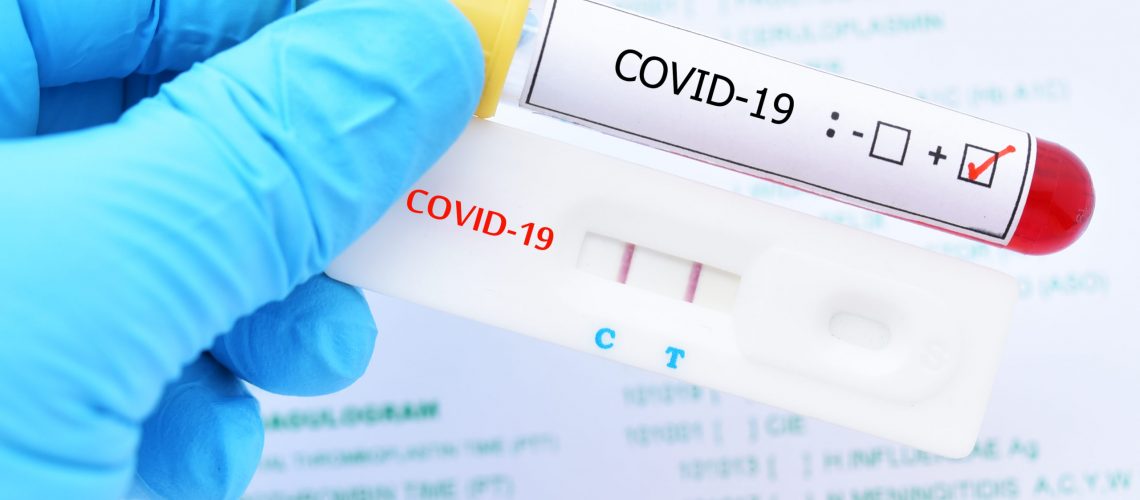 Positive test result by using rapid test device for COVID-19 virus, novel coronavirus 2019 found in Wuhan, China